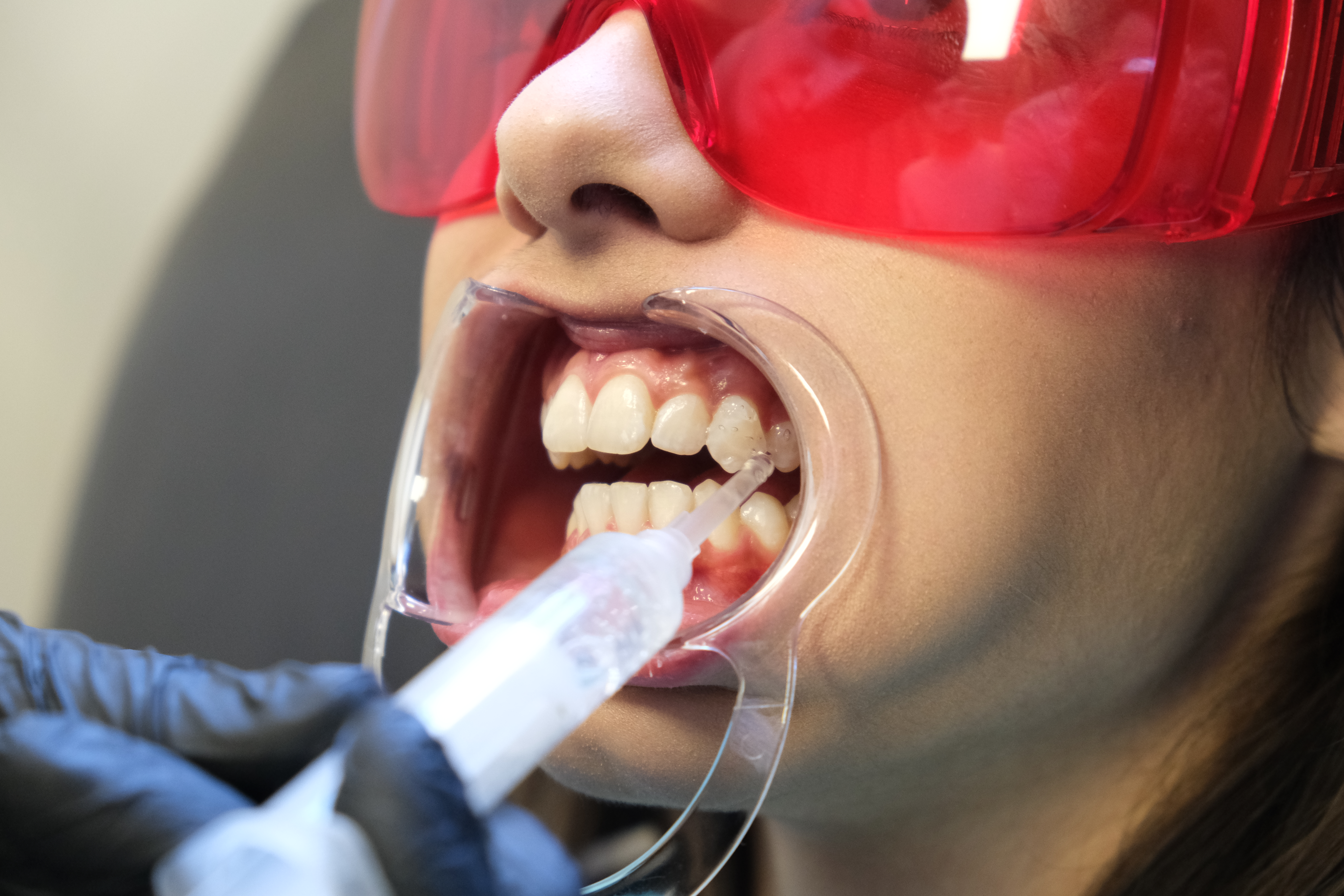 Картинка gel